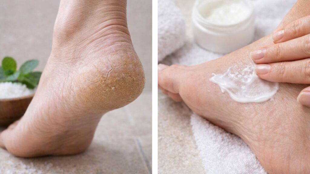 Home Remedies Repair