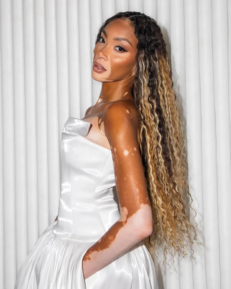 (Image credit: @winnieharlow)